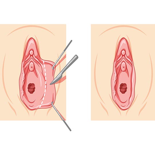 Chirurgie intime Tours