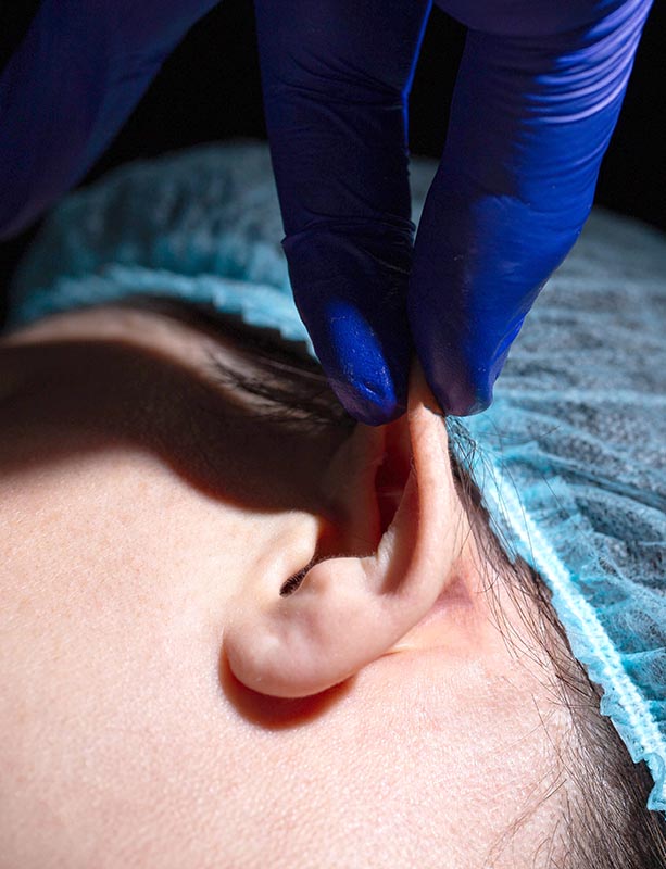 Remodelage cartilage oreille Tours